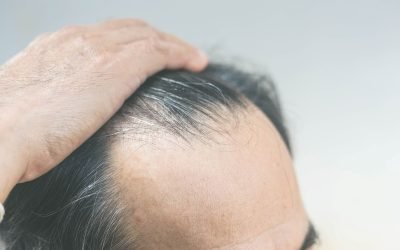 an overview of hair transplant surgery 1