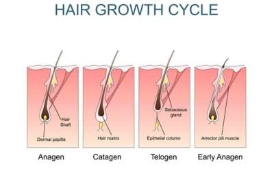 from hair loss to hair growth understanding hair transplantation 4
