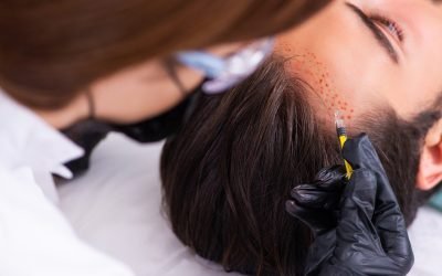 gaining confidence with hair transplantation 1