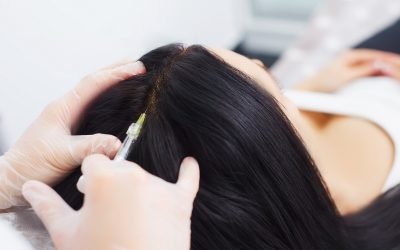 hair transplant a comprehensive guide