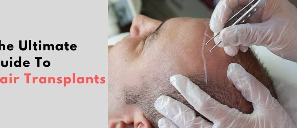 hair transplant maintenance how to keep results