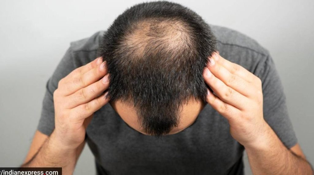 hair transplant surgery how to maintain results 1