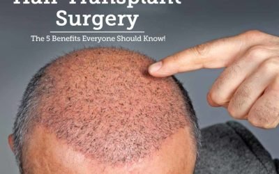 hair transplants the pros and cons