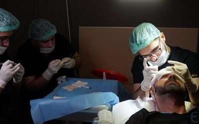 why hair transplantation can transform your look 2