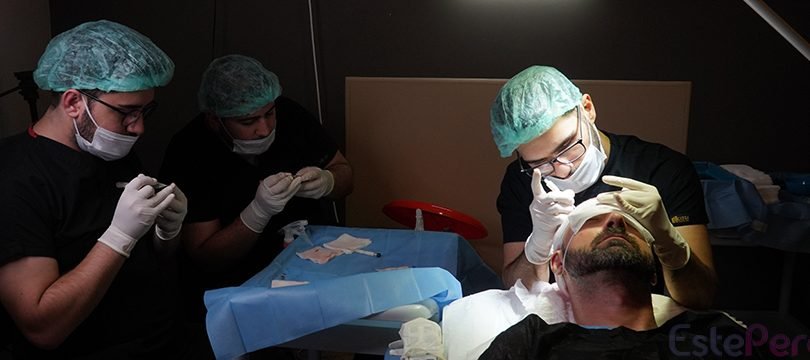 why hair transplantation can transform your look 2