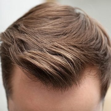 understanding hair transplant benefits and risks